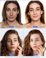 Load image into Gallery viewer, NEWKEY LED Face Mask Light Therapy,Red Light Therapy for Face Wrinkle Blue Light Therapy Mask for Face Acne,150LEDs,10 Min Auto Shut off, Wired

