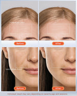 Load image into Gallery viewer, NEWKEY LED Face Mask Light Therapy,Red Light Therapy for Face Wrinkle Blue Light Therapy Mask for Face Acne,150LEDs,10 Min Auto Shut off, Wired
